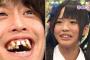 【悲報】日本人に「八重歯・出っ歯」が多い理由ｗｗｗｗｗｗｗｗｗｗｗｗｗｗｗｗ