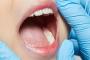 韓国人「日本、世界初歯の再生臨床試験推進」