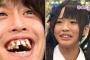 【韓国】日本人に「八重歯・出っ歯」が多い理由