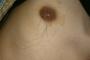 【くそスレ集】俺の乳首の毛長すぎｗｗｗｗｗｗｗｗ