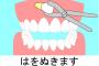 前歯虫歯になって人生終わった