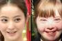 【悲報】「ダウン症」の白人女の子、日本人そっくりだと海外で話題に・・・（画像あり）