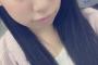 SKE48荒井優希「昨日おでん食べたから目が腫れてるだけです」←？？？