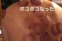 森友哉、凄惨ないじめを受ける