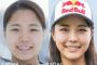 【炎上】高梨沙羅さん、施術した美容整形外科医に整形を暴露されるｗｗｗｗｗｗｗｗｗ