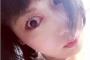 【悲報】鳥居みゆき、首が捻じ曲がる