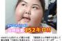 【画像】152kg女子が痩せた結果ｗｗｗｗｗｗ