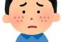ワイ「あ、顔に白いニキビあるなぁ。」　手で掴んでﾋﾟｭｯ!!　ワイ「ふぅ」