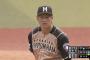 【画像】日ハム吉田輝星さん、とんでもない顔になってしまうｗｗｗ