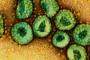 韓国でＭＥＲＳ「完治」の男性が再発熱…陽性に