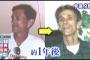 家族の病気事情って結婚相手にどこまで話すべき？ウチは通風と糖尿がすごく多いんだが、結婚後にバレるとやばいんだろうか？