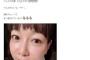 【韓国でレーザー治療が不評】堀ちえみ「違和感しかない」、 高須院長も苦言	