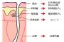 彼女が皮膚がんなんだって。今までずっと隠されてた。今後が不安になったけど、重病がわかった途端それ理由に別れるってなんか…