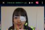 【悲報】NMB48三宅ゆりあちゃん、左目負傷し眼帯で配信