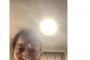 【立憲・原口一博】肋骨7本骨折・右目打撲で入院報告も、言い回しが曖昧なせいか、陰謀論者らが「襲撃」を勘繰り→本人が否定するも…