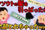 【2ch面白スレ】娘の歯列矯正を「不自然」「整形と同じ」と言っ放った義父のヅラを池にぶん投げた【義父スカッと3連発】【ゆっくり解説】