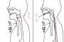お餅がなぜ細かく切っても喉に詰まって死ぬかを図解してみた！みんなも気をつけよう！！