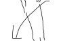 伸びをすると意識失う系女子なんだけどナンデ？