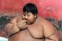 【速報】世界一デブな１０歳がこれwwww体重１９２キロ・・・これヤバいだろ・・・