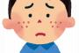 【マヂキチ】笑った勢いでニキビ汁飛び出して友人の顔に掛かってワロタｗｗｗｗｗ