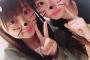 【朗報】頭骨折したAKB48稲垣香織がレッスンに復帰！事故から二週間超人的な回復をみせる！！