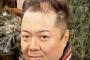 【超画像】ブラマヨ小杉さん、ハゲる寸前