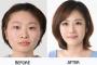 顔から好きになった女性が実は整形だったと知ったら・・・？衝撃のアンケート結果がこちら