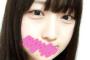 SKE48 8期生 矢作有紀奈の傷が意外と深刻そう・・・