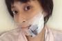 小林麻央、ガン転移しすぎてアゴから癌細胞が飛び出ていた…。（画像）