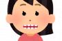 【納得】育ちの悪さが一番悪く出るパーツって「歯」！！！