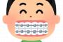 【画像ありw】歯の矯正を始めた女さん、めっちゃ綺麗になるｗｗｗｗｗｗｗｗｗｗｗｗｗｗｗｗｗｗｗｗｗｗｗ 	
