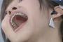 【画像】指原の虫歯ｗｗｗｗｗｗｗｗｗｗｗｗｗｗｗｗｗ