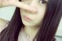 SKE48 古畑奈和 「お顔の骨を正しい位置に戻していただきました」