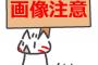 【悲報】ワイ、ケツ穴が切れる