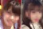 700万円かけて整形したコスプレイヤーさんのビフォーアフターがこちらｗｗｗ（画像あり）