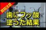 幼女が医者にフッ酸塗られ大人10人を弾き飛ばしてかっ飛んだ事故 	