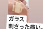 【SKE48】水野愛理さん、足の裏を怪我する・・・